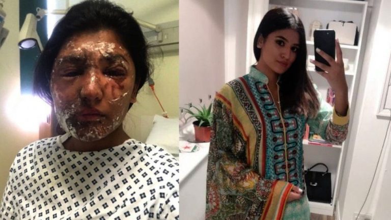 PICS: Acid Attack Victim, Resham Khan shows off her unbelievable recovery